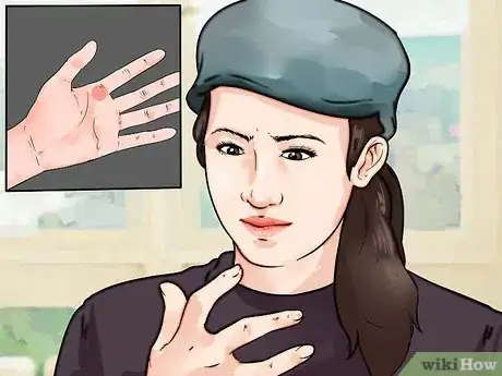 Image titled Know if You Have Trigger Finger Step 1