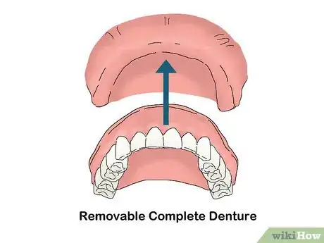 Image titled Buy Dentures Step 7