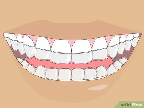 Image titled Stop Grinding Teeth at Night Step 7