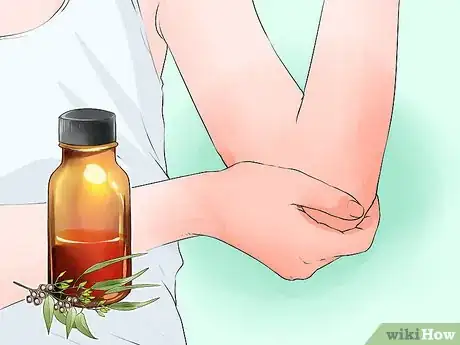 Image titled Use Herbs for Sprains and Bruises Step 2