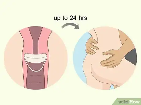 Image titled Use the Birth Control Sponge Step 7