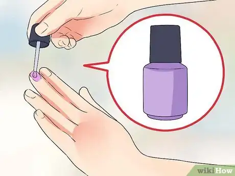 Image titled Know if You Have Nail Fungus Step 12