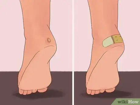 Image titled Have Flawless Feet Step 7