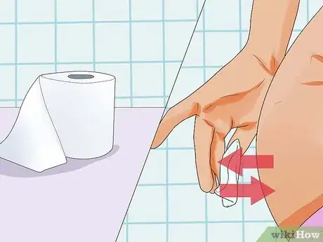 Image titled Stop Bleeding Hemorrhoids Step 4