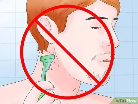 Image titled Treat Folliculitis Step 12