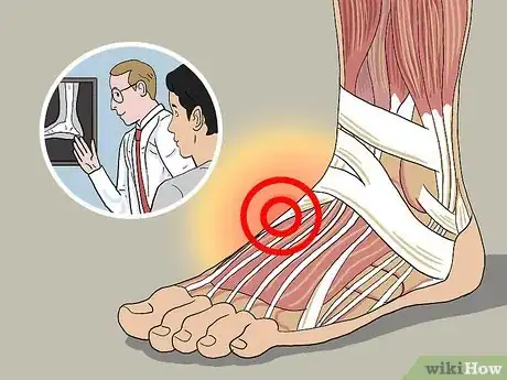 Image titled Treat Pain at the Top of the Foot Step 3