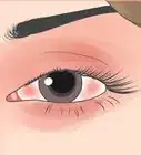 Stop Your Eye or Eyebrow from Jumping