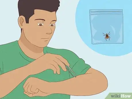 Image titled Identify Insect Bites Step 16