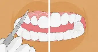 Straighten Your Teeth Without Braces