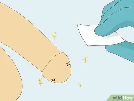 Image titled Pierce Your Own Penis Step 9