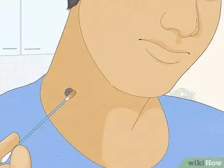 Image titled Remove a Mole with Iodine Step 10