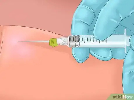 Image titled Determine Positive and Negative Blood Types Step 5