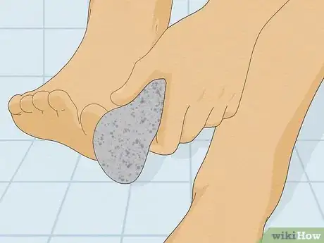 Image titled Control Foot Odor with Baking Soda Step 18