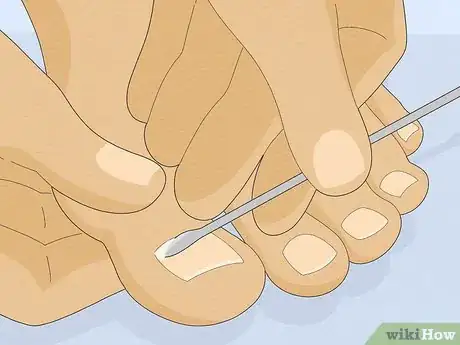 Image titled Have Pretty Toenails Step 10
