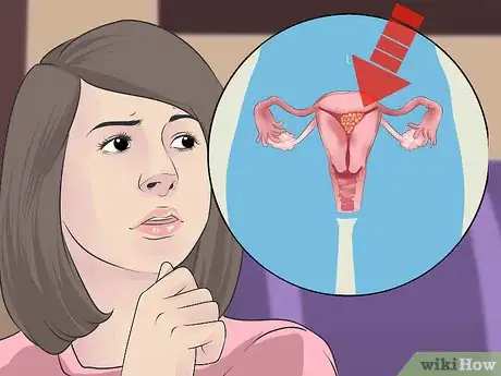 Image titled Prevent Molar Pregnancy Step 2