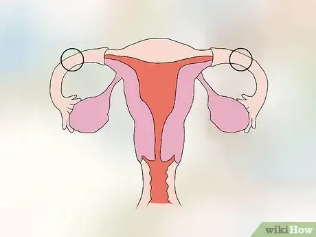 Image titled Avoid Getting an Abortion Step 19