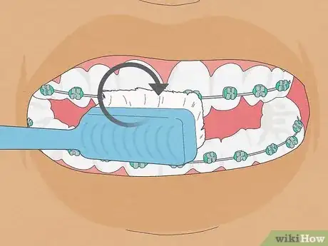 Image titled Brush Your Teeth With Braces On Step 1