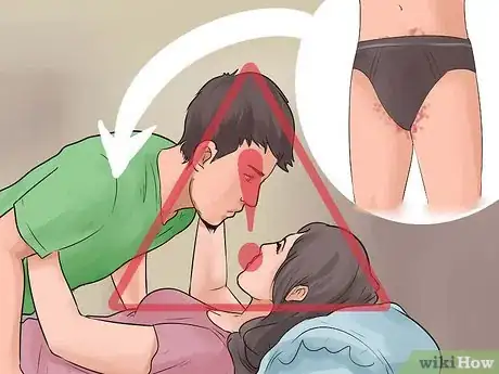 Image titled Have Sex with Someone with Herpes Step 2