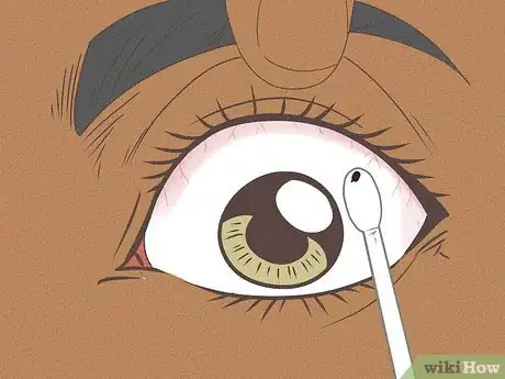 Image titled Get Dirt Out of Your Eye Step 5