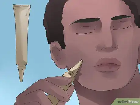 Image titled Remove Blackheads Step 17