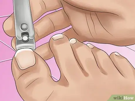 Image titled Clean Toe Nails Step 11