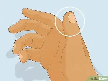 Image titled Stop Biting Your Fingers Step 4