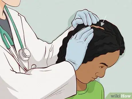 Image titled Treat Dry Scalp in African American Hair Step 10