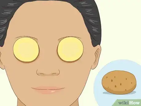 Image titled Get Rid of Puffy Eyelids Step 4