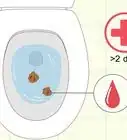 Naturally Treat Diarrhea During Pregnancy