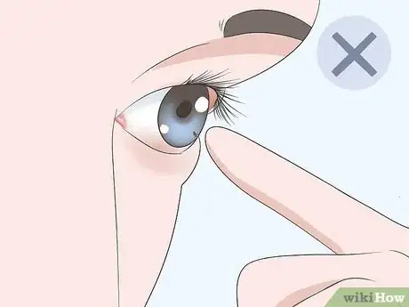 Image titled Get Sand Out of Your Eyes Step 13