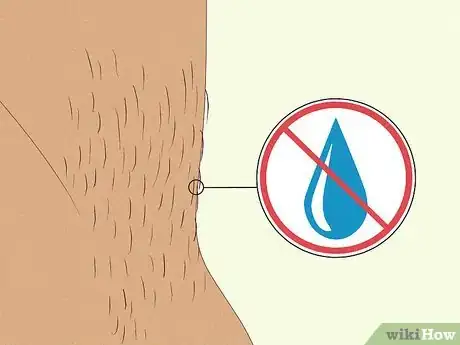 Image titled Remove Male Pubic Hair Without Shaving Step 2