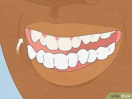 Image titled Straighten Your Teeth Without Braces Step 15