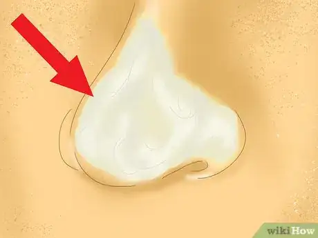 Image titled Remove Blackheads (Baking Soda and Water Method) Step 4