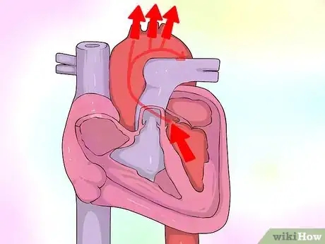 Image titled Interpret Echocardiograms Step 2