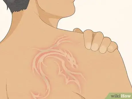 Image titled Fix a Bad Tattoo Step 9