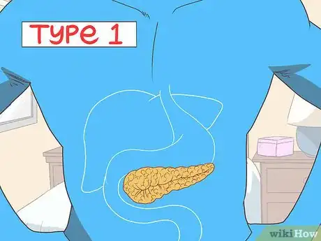 Image titled Understand the Difference Between Type 1 and Type 2 Diabetes Step 2