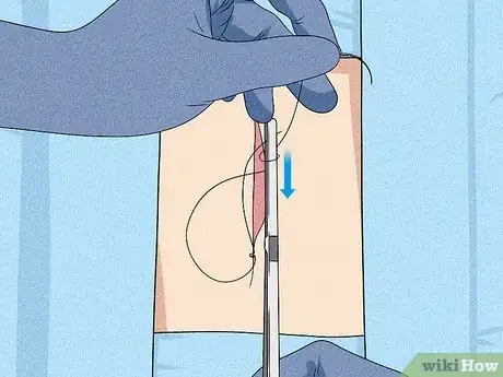 Image titled Perform an Instrument Tie Surgeon's Knot Step 18