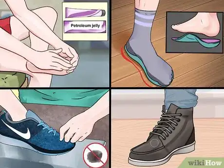 Image titled Prevent Foot Blisters Step 12