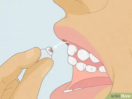 Image titled Pull a Loose Tooth at Home Step 4