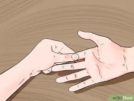 Image titled Know if You Have Trigger Finger Step 6