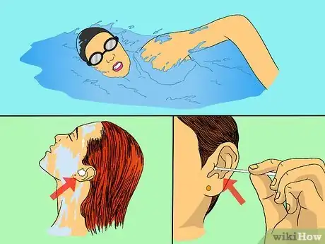 Image titled Get Rid of Swimmer's Ear Step 2