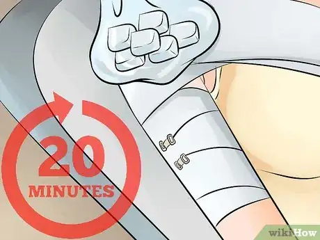 Image titled Apply Shoulder Injury Compression Wraps Step 19
