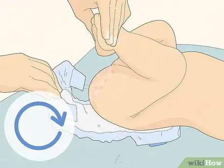 Image titled Use Coconut Oil for Diaper Rash Step 6