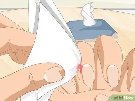 Image titled Heal Cuticles Step 2