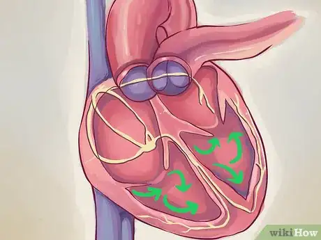 Image titled Interpret Echocardiograms Step 3