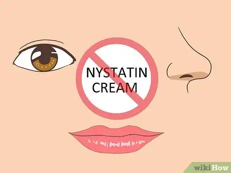 Image titled Use Nystatin Cream Step 11