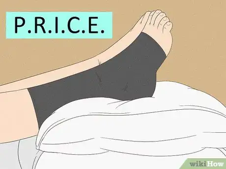 Image titled Treat a Broken Ankle Step 17