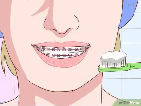 Image titled Avoid Pain When Your Braces Are Tightened Step 12