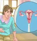Prevent Spotting Between Periods