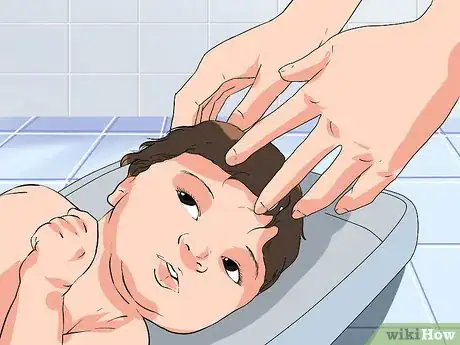 Image titled Prevent Cradle Cap Step 2